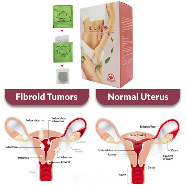 20 confezioni/scatola tè caldo utero tè disintossicante tè fibroide per donna SLS
