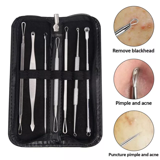 7x Blackhead Remover Tool Kit Acne Pimple Spot Comedone Extractor Popper Comedon