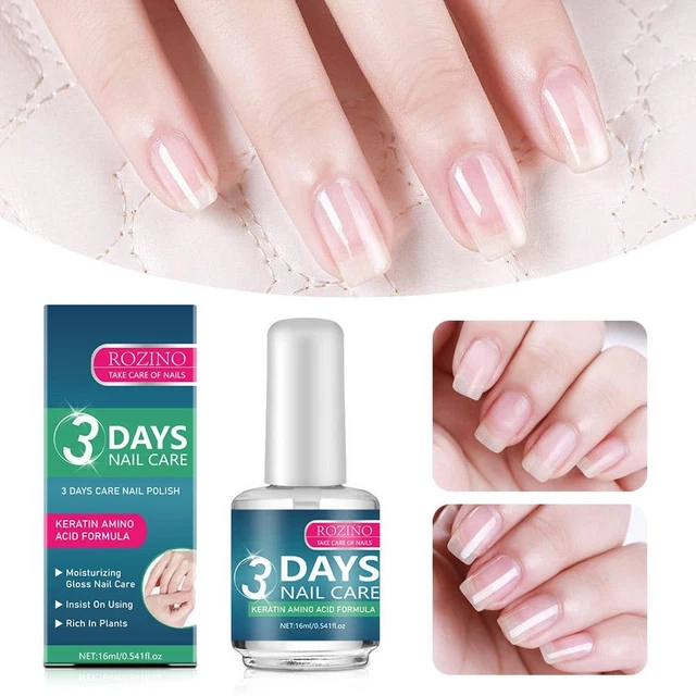 Lot De 5 Pinces à Cartes Extracteur En Acrylique - Pour Ongles Longs, Portefeuille, Sac Et Porte-clés