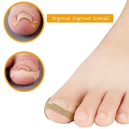 Autocollants de Correction des Ongles 40Pcs Traitement d'ongle de Paronychia Réc 2