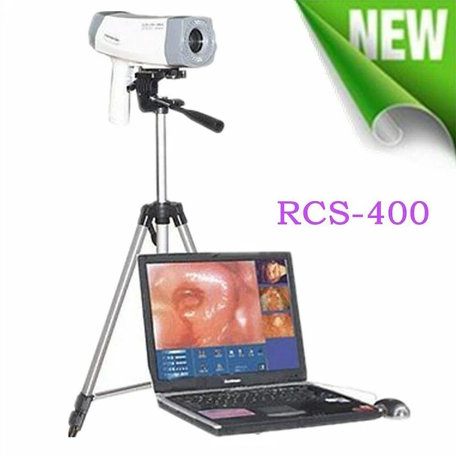 Electronic Colposcope High Resolution Camera Gynecology Colposcopy &Tripod