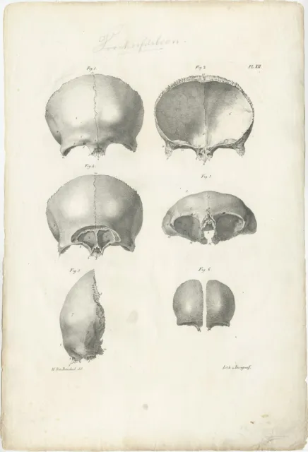 Pl. XII Antique Anatomy / Medical Print of the Skull