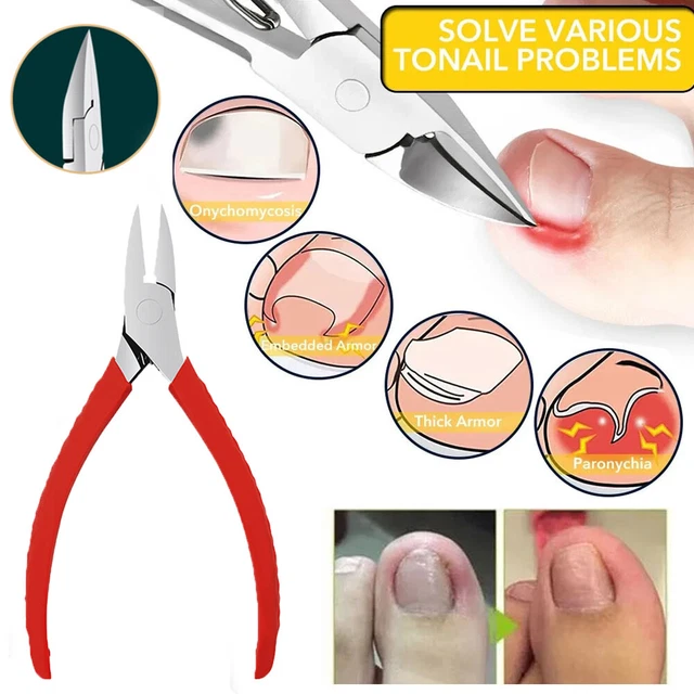 Coupe-Ongles Pour Enlever La Peau Morte Pince À Cuticules Outil Pour ✿