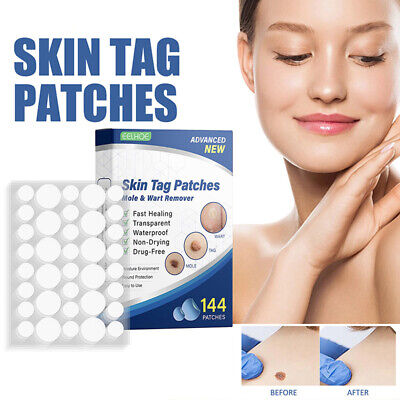 144 piezas removedor de etiquetas de piel parche rápido eficaz topo almohadilla eliminación de verrugas ~