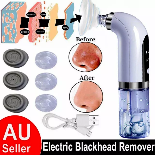 Electric Blackhead Remover Pore Vacuum Face Facial Suction Acne Cleaner Kit AU