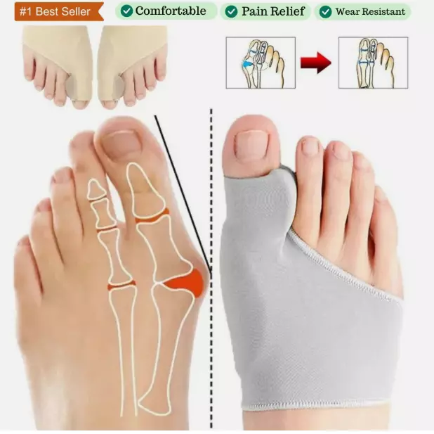 2PCS Big Toe Bunion Corrector Splint Straightener Feet Pain Relief Hallux Valgus