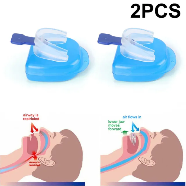 2PCS Stop Snoring Tray Guard Anti Snore Sleep Bruxism No Apnea Sleep Aid