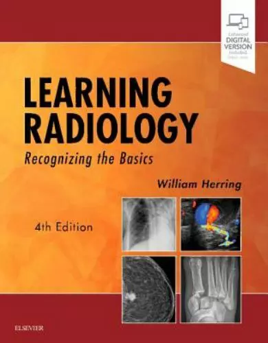 Learning Radiology : Recognizing the Basics by William Herring (2019, Trade...