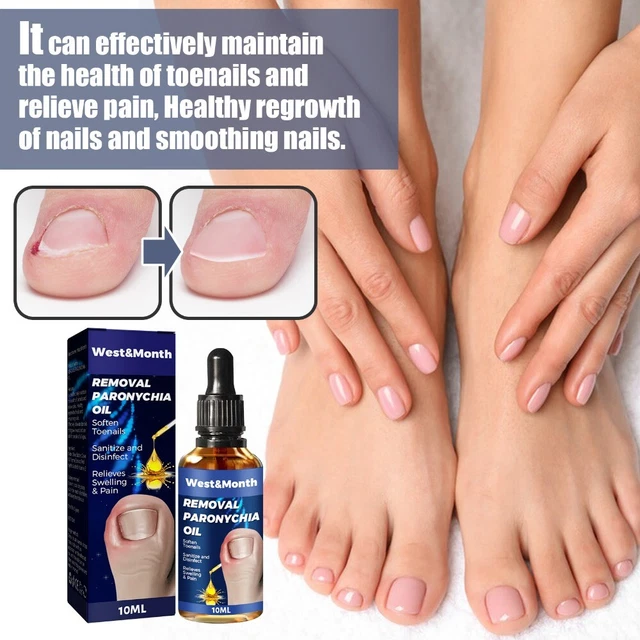 Nail Serum Ingrown Toenails Care Oil Paronychia Relief Oil Nail Recover Oils