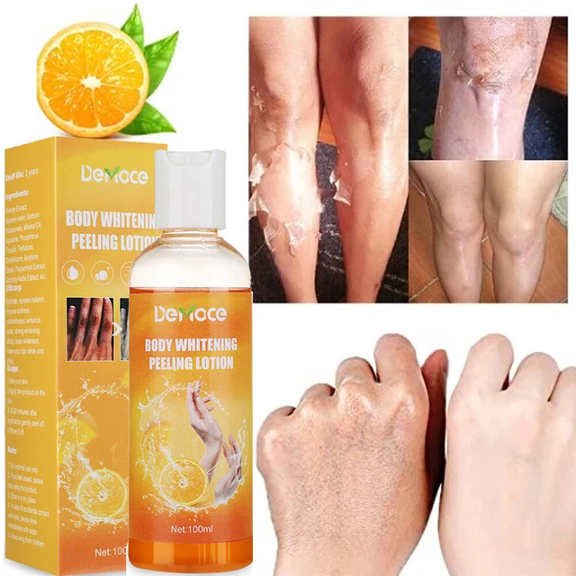 Skin Whitening Cream Dark Knuckle Finger Elbow Knee Bleaching Lightening Serum