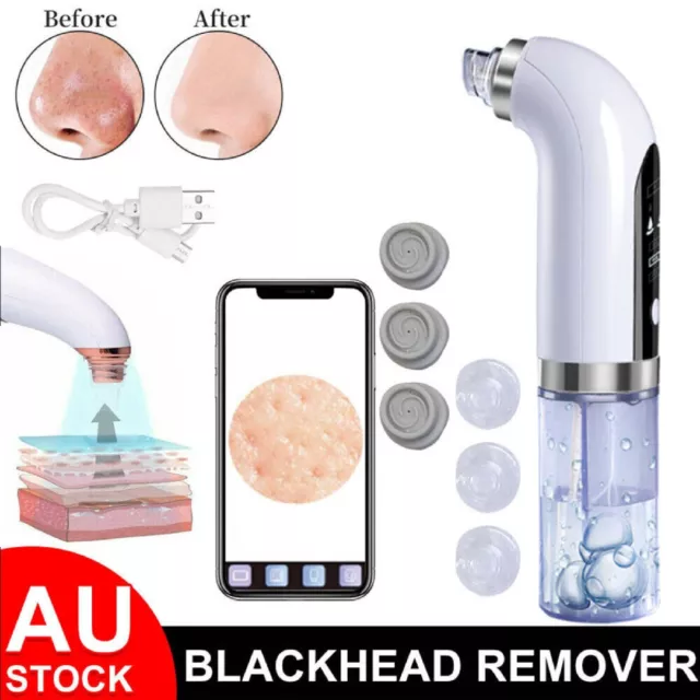 Electric Blackhead Remover Vacuum Pore Face Facial Suction Acne Cleaner Kit