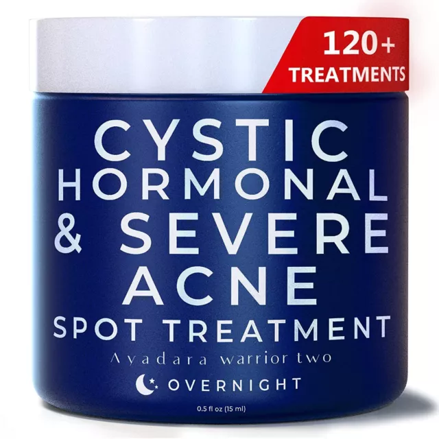 Ayadara Cystic Hormonal and Severe Acne Spot Treatment Overnight Cream, 120 Uses