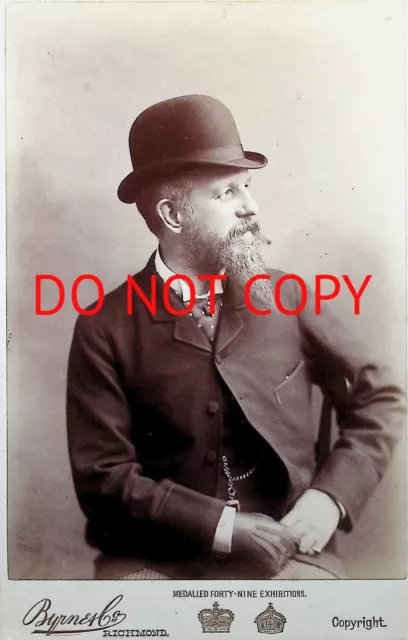 Man Bowler Hat Impressive Beard Cabinet Card Photograph Byrne & Co Richmond 844)