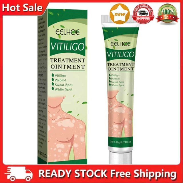 20 g crema macchia sudore promuovere la melanina vitiligine crema terapeutica per la salute del corpo