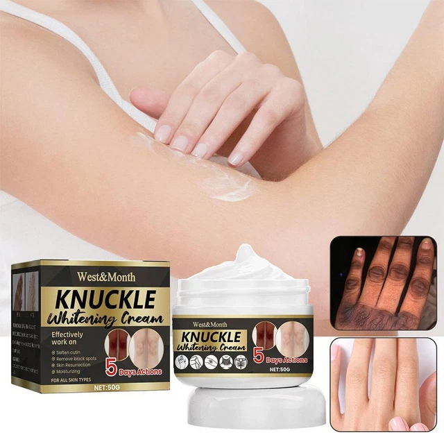 50 g Acantho crema pelle chiara, crema sbiancante nocche