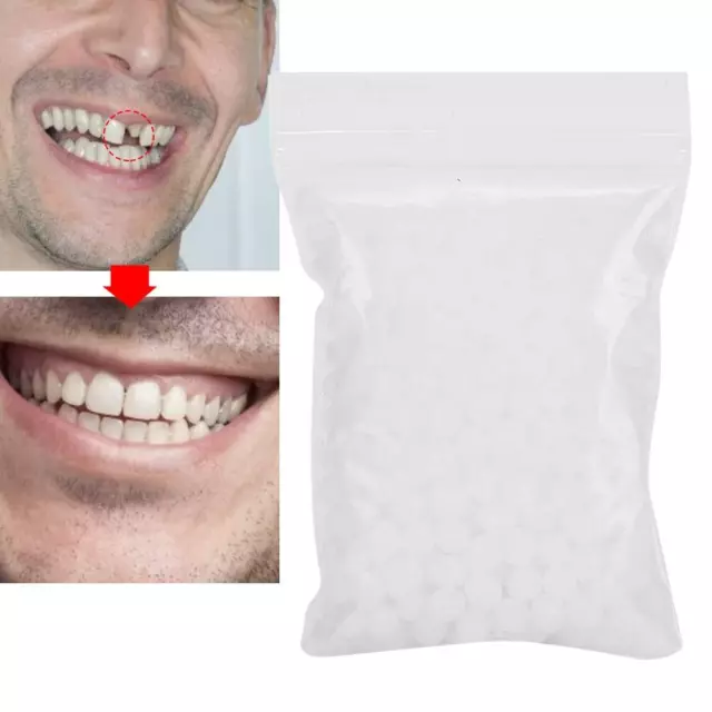 Kit di riparazione per denti temporanei per denti finti placcatura istantanea...