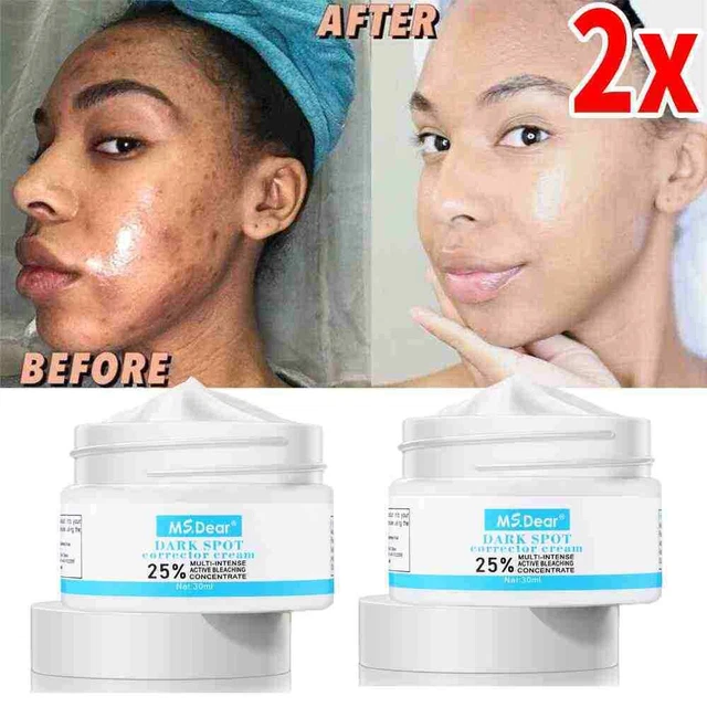 2 PACK Dark Spot Corrector Face Neck Skin Dark Spot Remover Cream Face Whitening