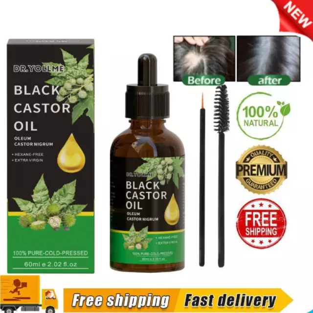 Jamaican Black Castor Oil,Organic- 100% Pure Cold Pressed Hair Growth Oil-