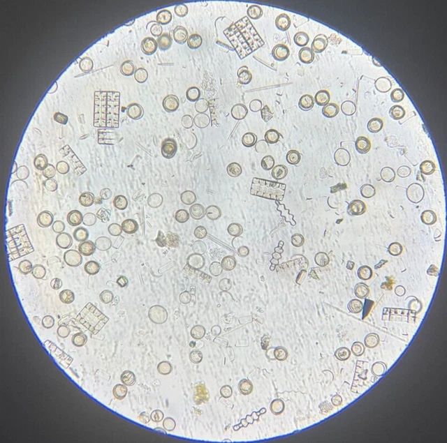 J.D. Moller Microscope Slide Diatom Aqua Dulcis Puerto Rico Gold Medal 1869