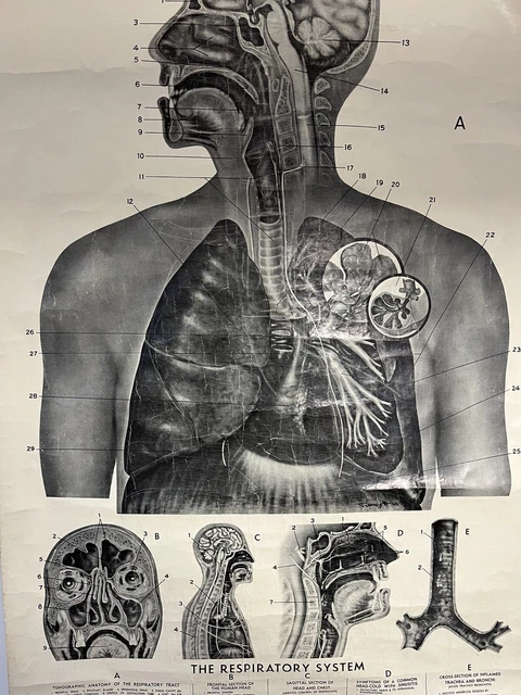 ANTIQUE VINTAGE ADAM Rouilly Wall Chart Poster Medical Respiratory ...