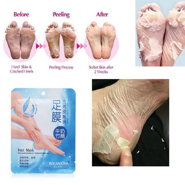 1 Pair Exfoliating Foot Masks Peeling Mask Remove Feet Dead Skin Callus ZR Sg
