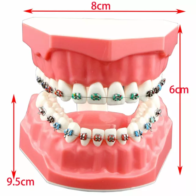 Dental Orthodontic Metal Bracket Buccal Tube 1:1Teach Study Typodont Teeth Model