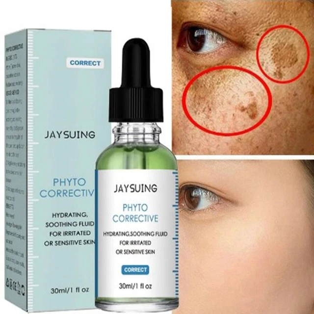 des imperfections Sérum d'élimination des taches de rousseur Sérum blanchissant