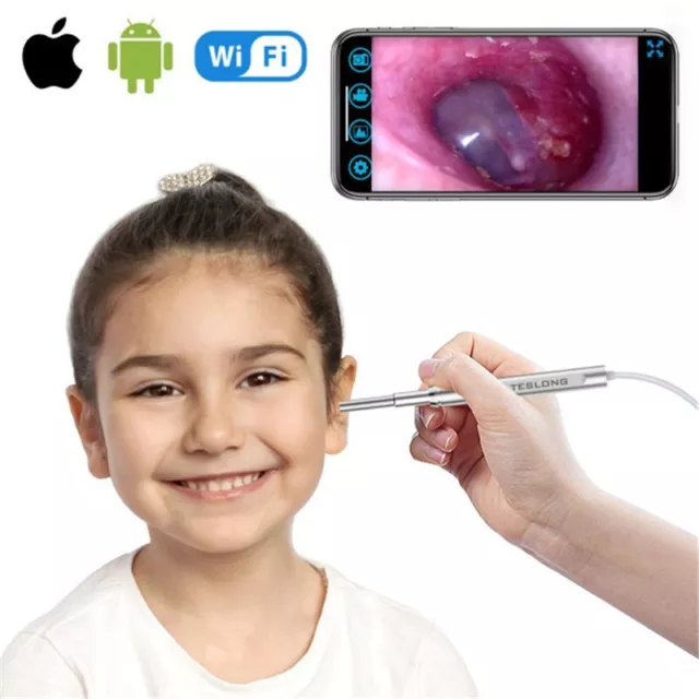 TESLONG 3.9mm WiFi Digital Otoscope Endoscope camera for iPhone Android Phones 3