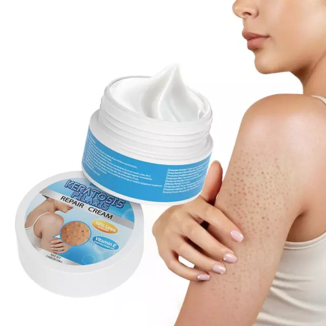 Salicylic Acid Urea Foot Cream Chicken Skin Removal Moisturizer Skin I8U1 A