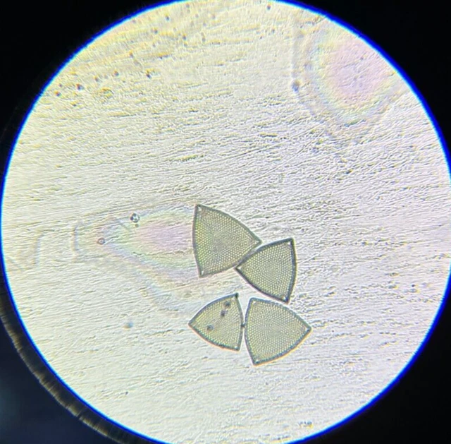 Antique A.C. Cole Microscope Slide Diatom Triceratium Fimbriatum Rio de Janeiro