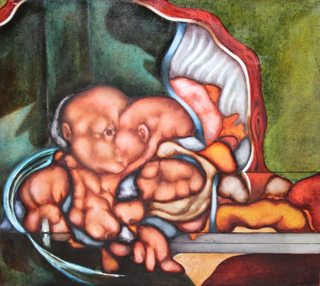 MARIO BEDINI (Sacile, Italia,1936 –Sant Celoni, BCN 2011) OLEO TELA DEFORMACIONE