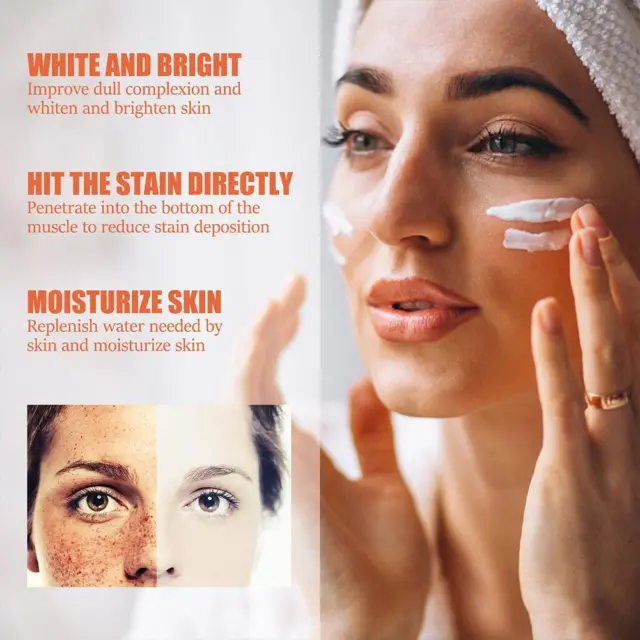 Crema blanqueadora efectiva para eliminar el pigmento melasma acné melanina manchas oscuras;
