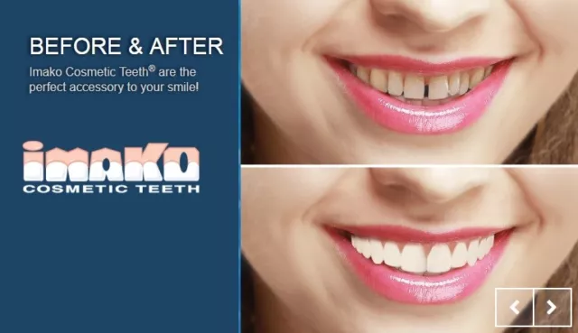 NEW IMAKO Perfect Smile Veneer Cosmetic Dental Hollywood Strictly Simon Cowell