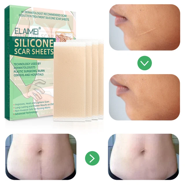 Toppa in silicone riutilizzabile riparazione pelle lavabile per trattamento rimozione cicatrici