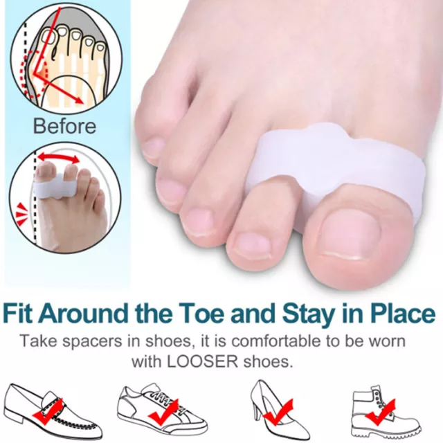 2PCS Silicone Foot Finger Toe Separator Hallux Valgus Corrector Feet Pain RY.go
