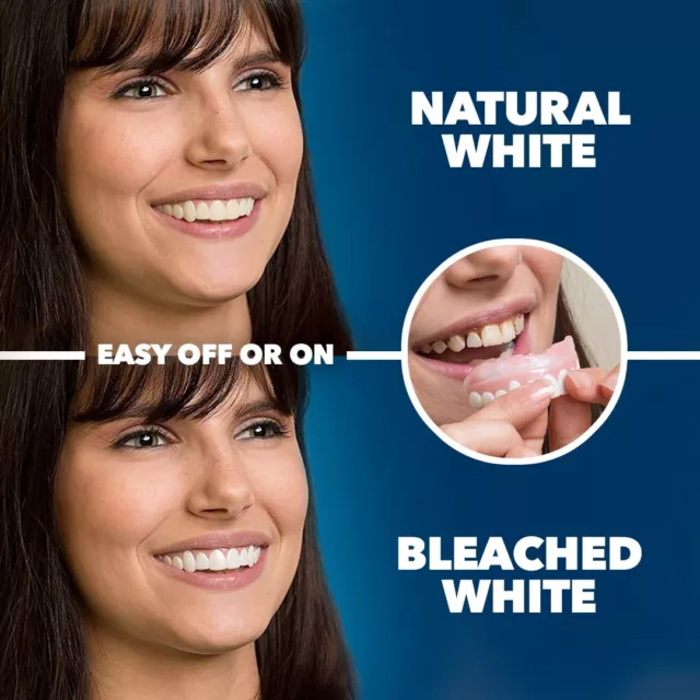 Dientes cosméticos premium Imako® pequeños blancos blanqueados - hágalo usted mismo cambio de imagen de sonrisa, hecho en EE. UU. 2
