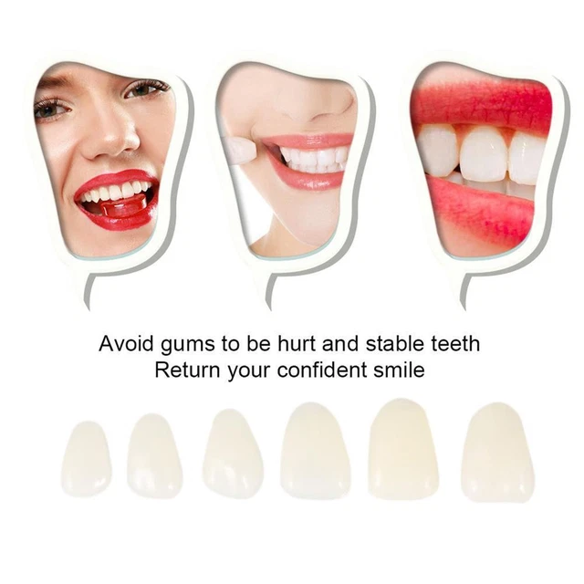 70 Pcs/set Dental Ultra-Thin Veneers Resin Teeth Upper Anterior Shade FAST P3D2