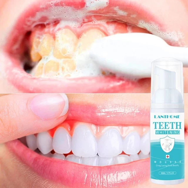 des dents Dentifrice Mousse blanchissante Lavage de la bouche Mousse dents