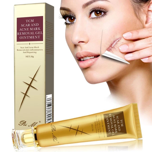 30 g crema rimozione cicatrici da acne brufoli rimozione smagliature rimozione viso BELLO R5O1