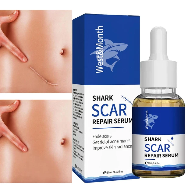 Rimozione cicatrici acne cura della pelle segni di stretching alleggeriscono vecchie cicatrici ustioni riparazione essenza