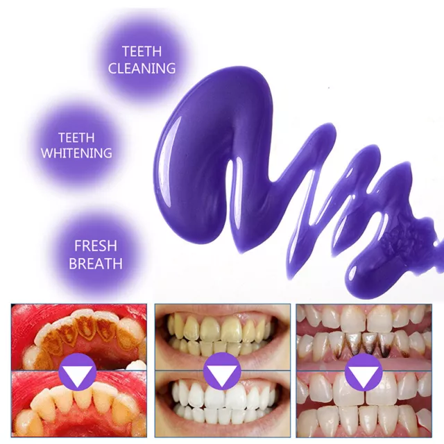 Teeth Whitening Toothpaste Mousse Effectively Remove Yellow Plaque Smoke Sta LEI