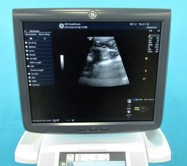 GE Logiq E9 Ultrasound 3