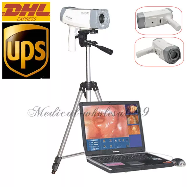 Carejoy Digital Video Electronic Colposcope 800,000px Tripod Software Newest