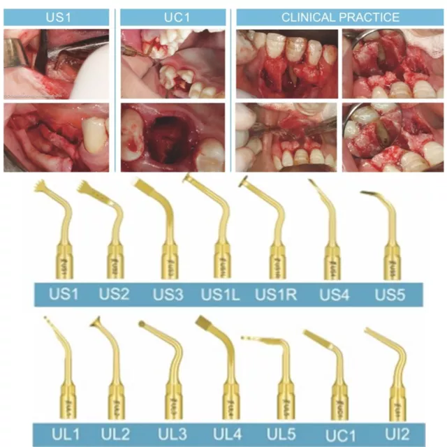 Woodpecker US-II LED Dental Piezo Bone Surgery Tips U Tips Fit NSK Handpiece