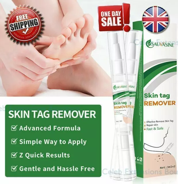 Wart Removal Treatment Liquid Pen's🌟 Painless Spot Mole Skin Tag ✅2x3ml Pens!