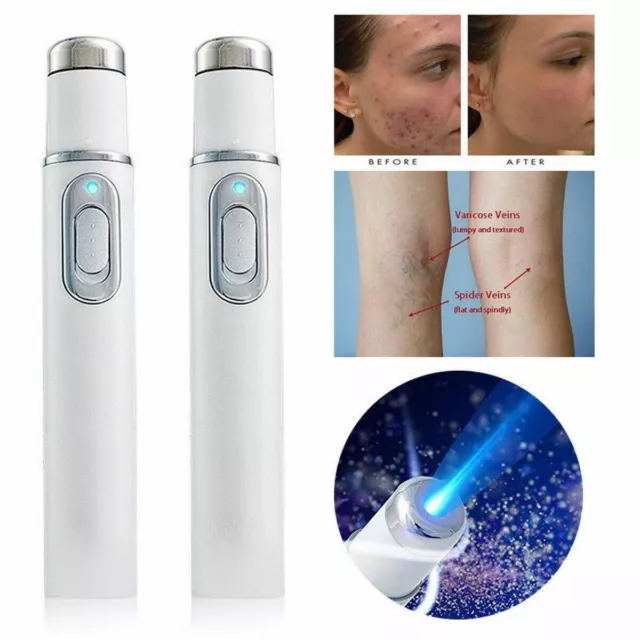 LCD Laser Plasma Pen Mole Dark Spot Skin Wart Tag Tattoo Removal Beauty Care DE