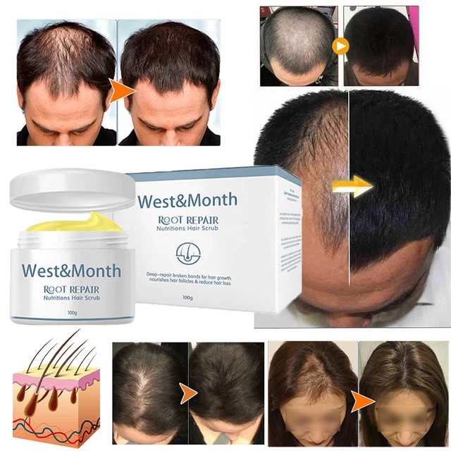 HAIR GROWTH SCRUB AntiHairLoss Baldness Prevention Cream Hair For