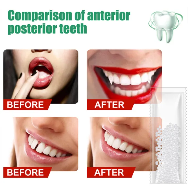 Denture Adhesivo Temporal Dental Kit de Reparación Dientes & Espacios Post < 3