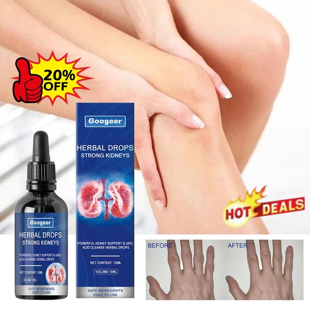 Kidney Uric Acid Herbal Drops for Optimal Support
