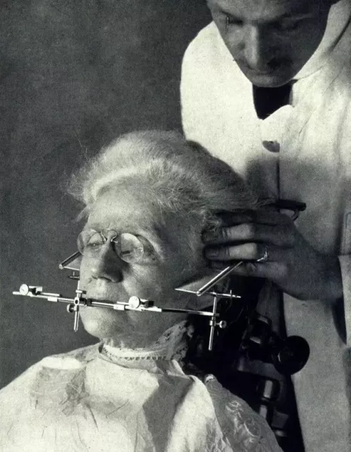 Antique Medical Jaw Device Photo 1195b Oddleys Strange & Bizarre